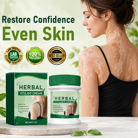 Herbal Vitiligo Cream